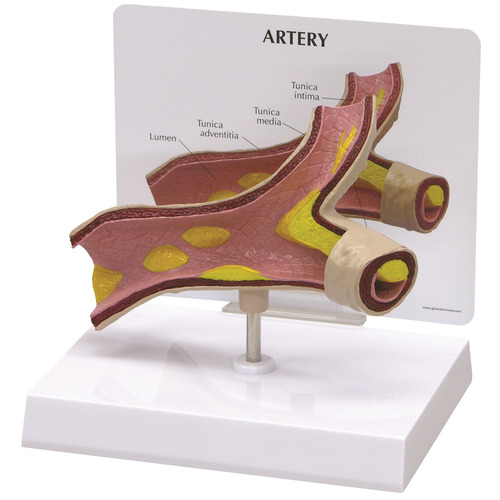 GPI2600 - GPI Manufacturing - Artery