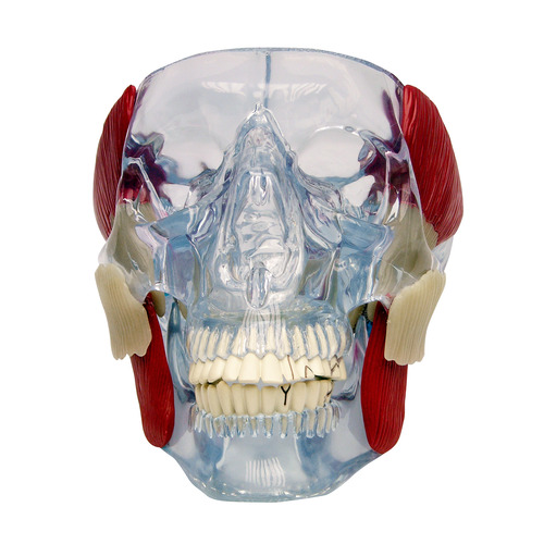 GPI2880 - GPI Manufacturing - Temporomandibular Joint (TMJ)