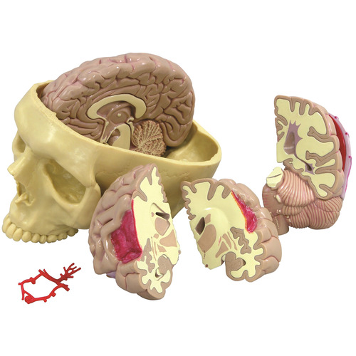 GPI2900 - GPI Manufacturing - Brain (Healthy/Pathologies)