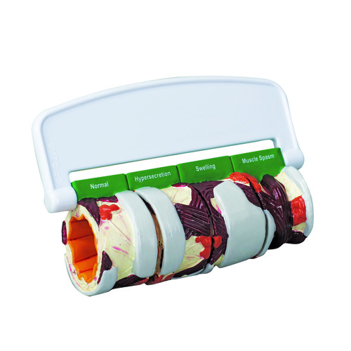 GPI3120 - GPI Manufacturing - 4-Piece Bronchus