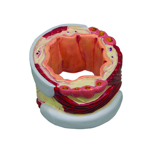 GPI3120 - GPI Manufacturing - 4-Piece Bronchus