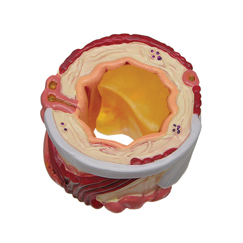 GPI3120 - GPI Manufacturing - 4-Piece Bronchus