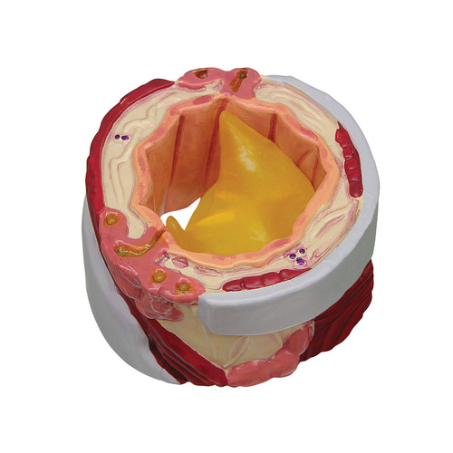 GPI3120 - GPI Manufacturing - 4-Piece Bronchus
