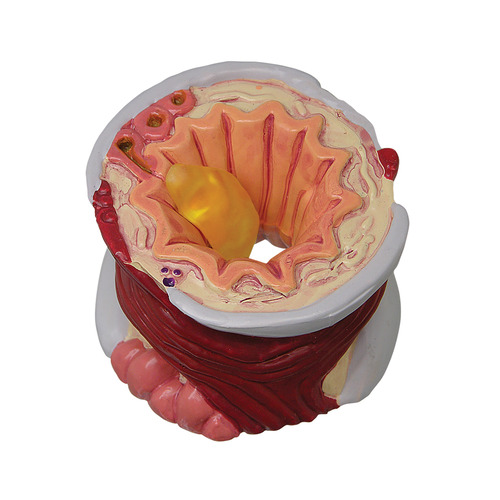 GPI3120 - GPI Manufacturing - 4-Piece Bronchus