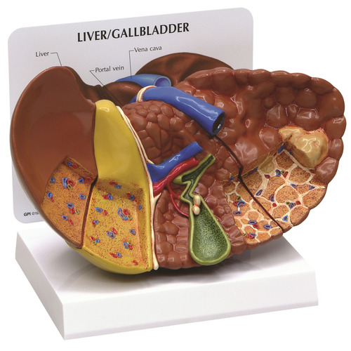 GPI3310 - GPI Manufacturing - Liver with Pathologies
