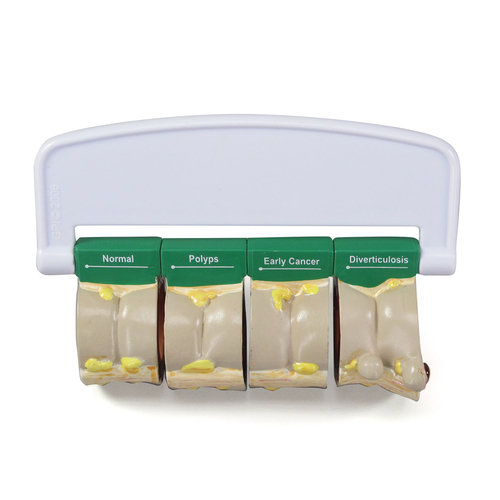 GPI3341 - GPI Manufacturing - 4-Piece Colon (with Pathologies)