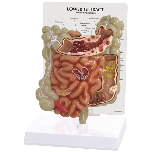GPI3342 - GPI Manufacturing - GI Tract