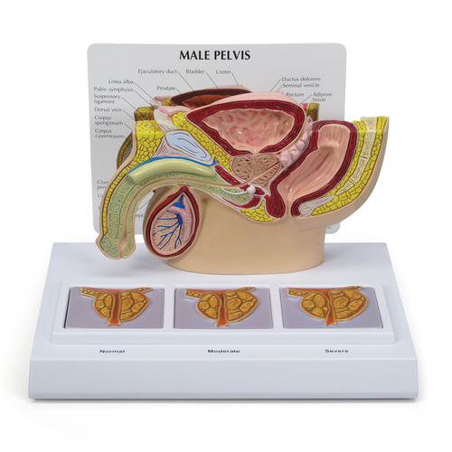 GPI3551 - GPI Manufacturing - Male Pelvis with 3D Prostate Frame