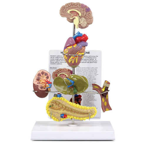 GPI4020 - GPI Manufacturing - Metabolic Syndrome Set
