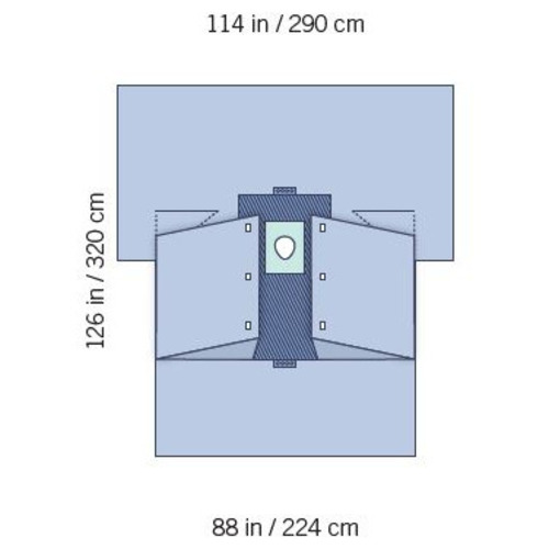 MON1013080CS - Invenio Healthcare - Orthopedic Drape Tech 70 Orthopedic Hand Hip Drape 114 W X 88 W X 126 L Inch Sterile, 6/CS