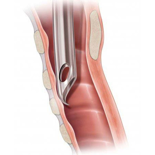 MON1044982CS - Sun Med - Sun Med Cuffed Endotracheal Tube Flex-Tip Curved 4.0 mm Pediatric Murphy Eye
