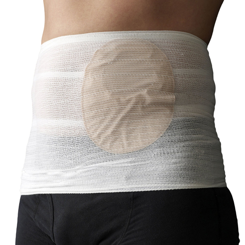 MON1088419CS - Tytex - BELT, OSTOMY STOMASAFE CLASSICSM 32"-40" (10/BG 3BG/CS, 30/CS