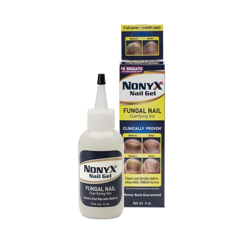MON1105892EA - Xenna Corp - Antifungal NonyX Gel 4 oz. Bottle, 1/EA