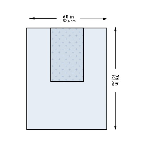 MON1130795CS - McKesson - McKesson General Purpose Drape Three-Quarter Drape 60 W x 76 L&quot; Sterile, 20 EA/CS