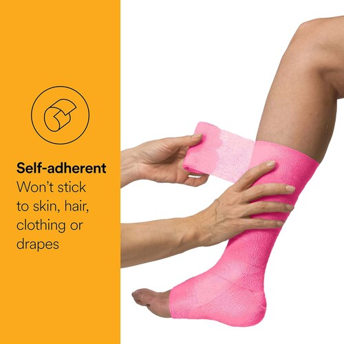 MON1238883CS - Solventum Corporation - Solventum Corporation Cohesive Bandage 3M&trade; Coban&trade; LF 2 Inch X 5 Yard Self-adherent Closure Pink NonSterile Standard Compression, 36/CS