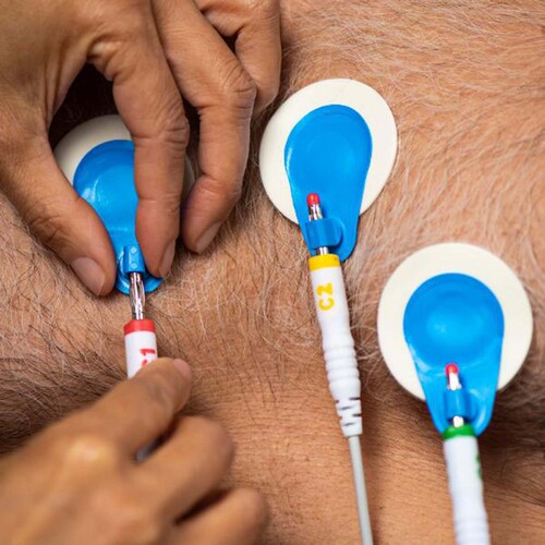 MON1250112PK - Ambu - Ambu ECG Stress Electrode BlueSensor R Offset Snap Connector Wet Gel Foam Backing Adult Non-Radiolucent 4 per Pack
