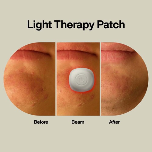 MON1252790EA - LED Technologies - Acne Light Therapy Patch Kit lab