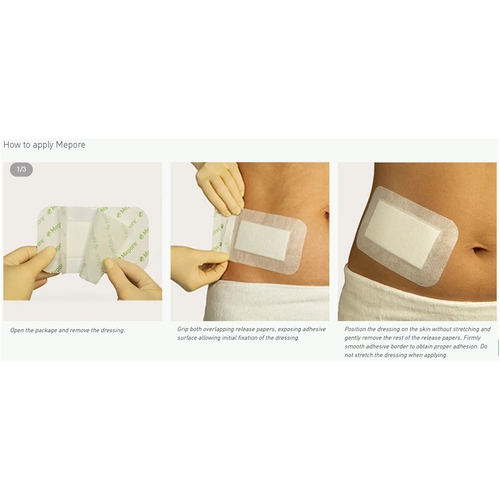 MON324383CS - Molnlycke Healthcare - Molnlycke Healthcare Adhesive Dressing Mepore 2.4" x 2.8" Viscose Nonwoven Coated with a Polymer Layer Square White Sterile, 480 EA/CS