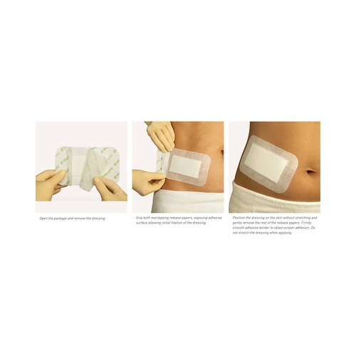 MON324385CS - Molnlycke Healthcare - Molnlycke Healthcare Adhesive Dressing Mepore 3.6" x 6" Viscose Nonwoven Coated with a Polymer Layer Rectangle White Sterile, 400 EA/CS
