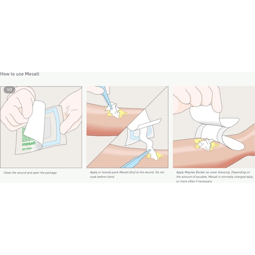 MON400463CS - Molnlycke Healthcare - Molnlycke Healthcare Impregnated Dressing Mesalt 6" x 6" Viscose / Polyester Sodium Chloride Sterile, 240 EA/CS