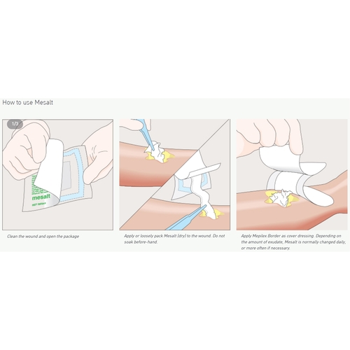 MON400464CS - Molnlycke Healthcare - Molnlycke Healthcare Impregnated Dressing Mesalt 4" x 4" Viscose / Polyester Sodium Chloride Sterile, 240 EA/CS