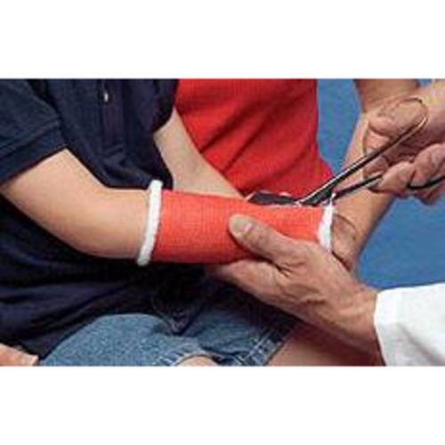MON440172BX - BSN Medical - Cast Tape Delta-Cast&reg; Conformable 2 Inch X 12 Foot Polyester Dark Blue, 10/BX