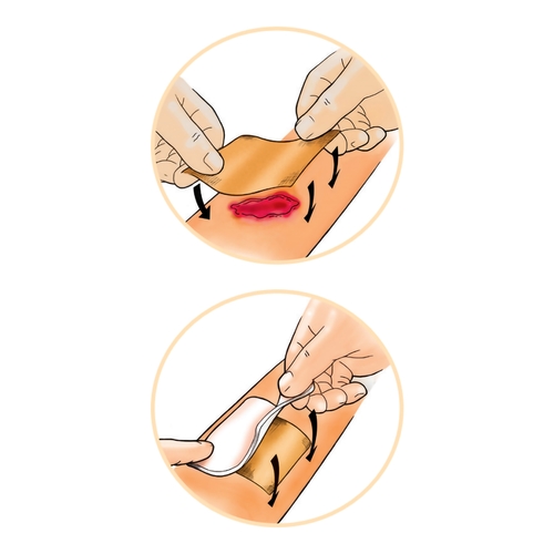 MON849681BX - Dukal - Impregnated Dressing Activon&reg; 2 x 2" Viscose Mesh Manuka Honey Sterile, 5/BX