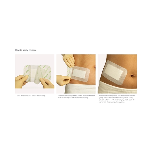 MON851135CS - Molnlycke Healthcare - Adhesive Dressing Mepore 3.6" x 12" Viscose Nonwoven Coated with a Polymer Layer White Sterile, 270 EA/CS
