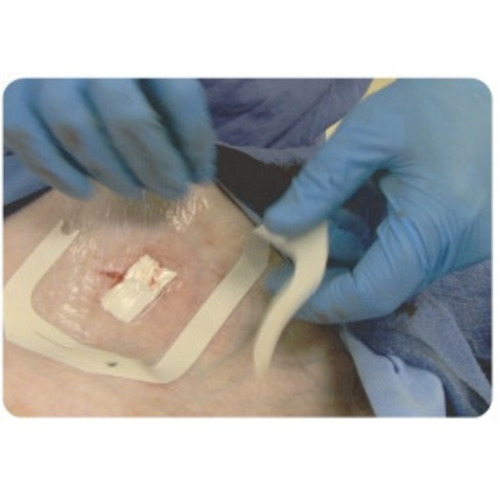 MON853847CS - Lifescience PLUS - Hemostatic Dressing BloodSTOP iX Sodium Carboxymethyl Cellulose