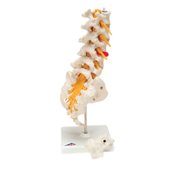 FNT12-4543 - Fabrication Enterprises - Anatomical Model - Lumbar Spinal Column with Dorso-Lateral Prolapsed Disc