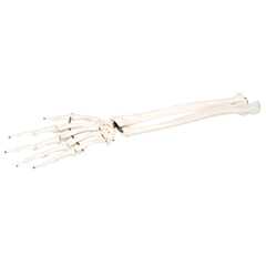 FNT12-4581R - Fabrication Enterprises - Anatomical Model - Loose Bones, Hand Skeleton with Ulna and Radius, Right (Wire)