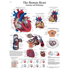 FNT12-4610L - Fabrication Enterprises - Anatomical Chart - Human Heart, Laminated