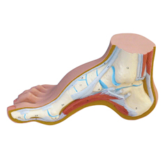 FNT12-4803 - Fabrication Enterprises - Anatomical Model - Hollow Foot (Pes Cavus)