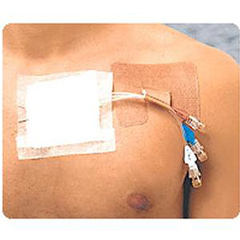Integra LifeSciences Cath-Strip Reclosable Catheter Fastener, 50/BX