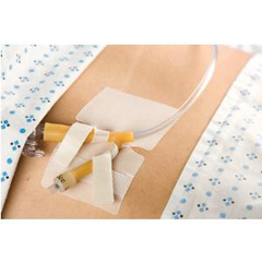 M.C. Johnson Co CATH-SECURE Dual Tab Multi-Purpose Tube Anchoring Device, 1/EA