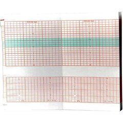 Cooper Surgical Fetal Diagnostic Monitor Recording Paper Edan&reg; Thermal Paper 90 mm X 152 mm Roll Red Grid, 3/BX