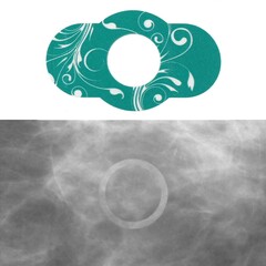 Precision Dynamic Radiology Skin Marker Spee-D-Line™ Swirl Collection™ Mole, 100/BX
