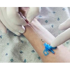 MON810097BX - B. Braun - Introcan Safety® 3 Closed IV Catheter (4251129-02), 50 EA/BX