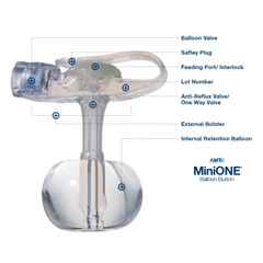 MON1053705EA - Applied Medical Technologies - Mini ONE® Low Profile Balloon Button Gastrostomy Tube (M1-5-1210-I)