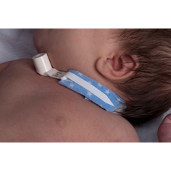 MON407376EA - Dale Medical - Tracheostomy Tube Holder PediPrints™