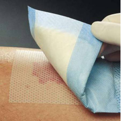 MON712204CS - Molnlycke Healthcare - Wound Dressing Mepitel Silicone 3 x 2 Sterile