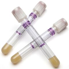 BD Vacutainer PPT Venous Blood Collection Tube Plasma Tube K2 EDTA / Separator Gel Additive 13 x 100 mm 5 mL Pearlesent White BD Hemogard Closure Plastic Tube, 1000 EA/CS