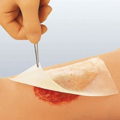 Smith & Nephew Impregnated Dressing Cuticerin 4
