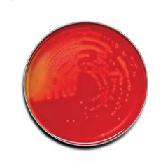 MON881676BX - BD - Prepared Media BD BBL Trypticase Soy Agar with 5% Sheep Blood (TSA II) Dark Red Mono-Plate Format, 100/BX