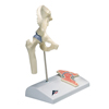 Fabrication Enterprises Anatomical Model - Mini Hip Joint with Cross Section of Bone on Base FNT 12-4517