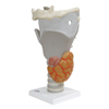 Fabrication Enterprises Anatomical Model - Functional Larynx (2.5x Size) FNT12-4569