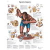 Fabrication Enterprises Anatomical Chart - Sports Injuries, Laminated FNT12-4623L