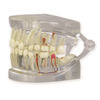 GPI Manufacturing Clear Human Jaw with Teeth (Healthy/Pathologies) GPI2861